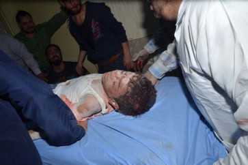 اصابة طفل بقذائف الارهاب في حلب - ارشيف