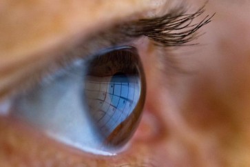 في حال تشخيص الإصابة بالسكري ‫حديثا، ينبغي على المرضى استشارة طبيب عيون