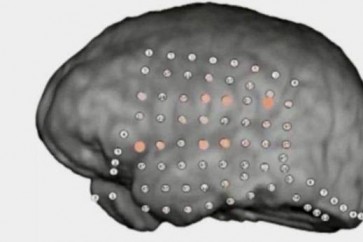العلماء ينجحون في تصوير نشاط الدماغ في الفهم أثناء الضجيج