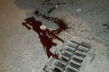 اثار دماء احد المعتصمين أمام منزل الشيخ قاسم