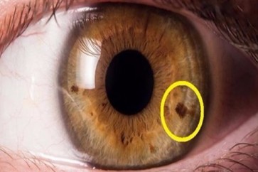 حدقة العين توضح معلومات عن الحالة الداخلية للإنسان