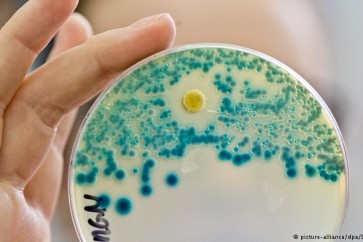 هذه البكتيريا التي تسبح بسرعة كبيرة