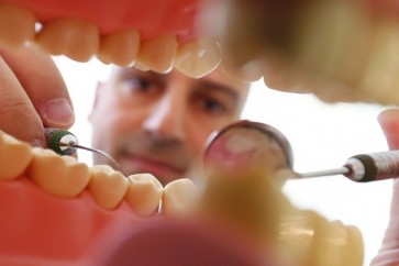 علماء يطورون حشوة أسنان خارقة