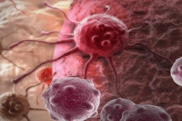 علاج جديد يطيل العمر في المراحل المتقدمة للسرطان