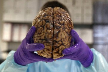 علماء الآثار يعثرون على أقدم دماغ بشري في العالم