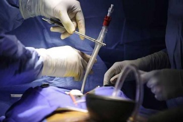 فريق طبي هندي ينجح في إجراء جراحة قلبية خطيرة