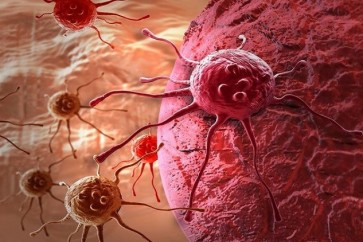 تطوير تقنية تدفع الخلايا السرطانية إلى "الانتحار"