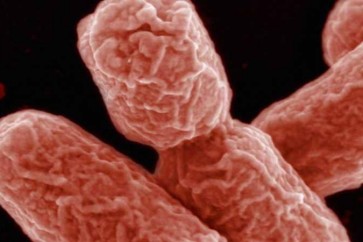 القضاء على البكتيريا "الخارقة".. بفيروسات "تأكلها"