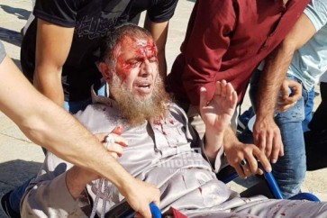إصابات في مواجهات عنيفة في المسجد الأقصى 