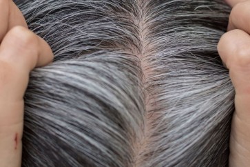 White Hair1